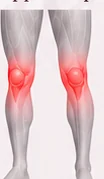 Planche anatomique des jambes, les deux genoux marqués en rouge